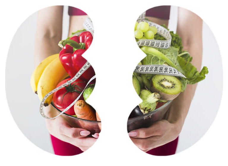 Cálculos renales: ¿Qué comer y qué evitar?